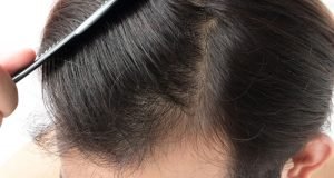 Haartransplantation Haarersatz