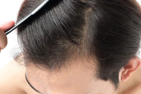 Haartransplantation Haarersatz