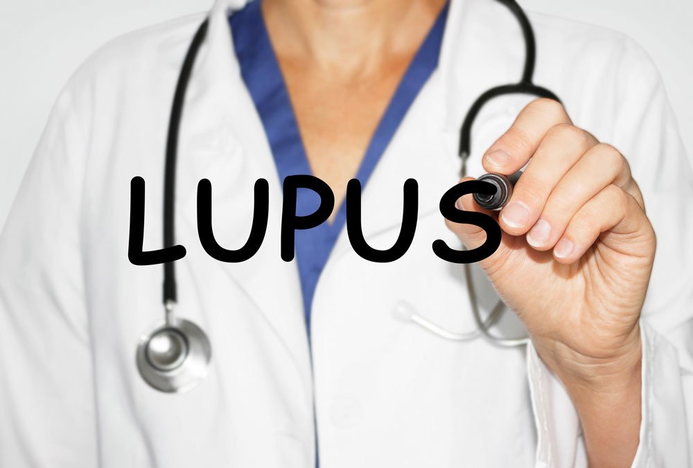 Lupus