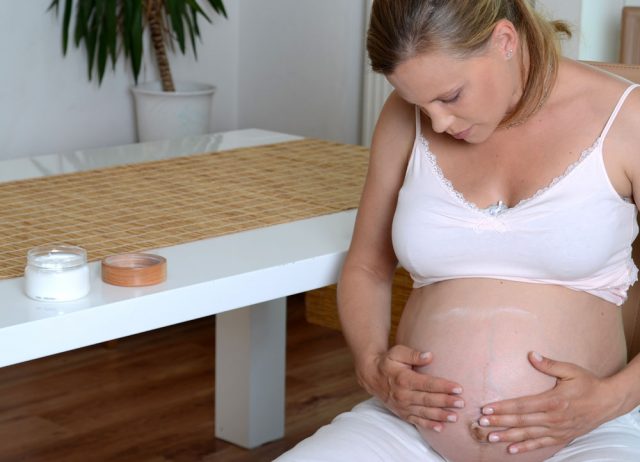 Schwangerschaftsstreifen entfernen und vorbeugen