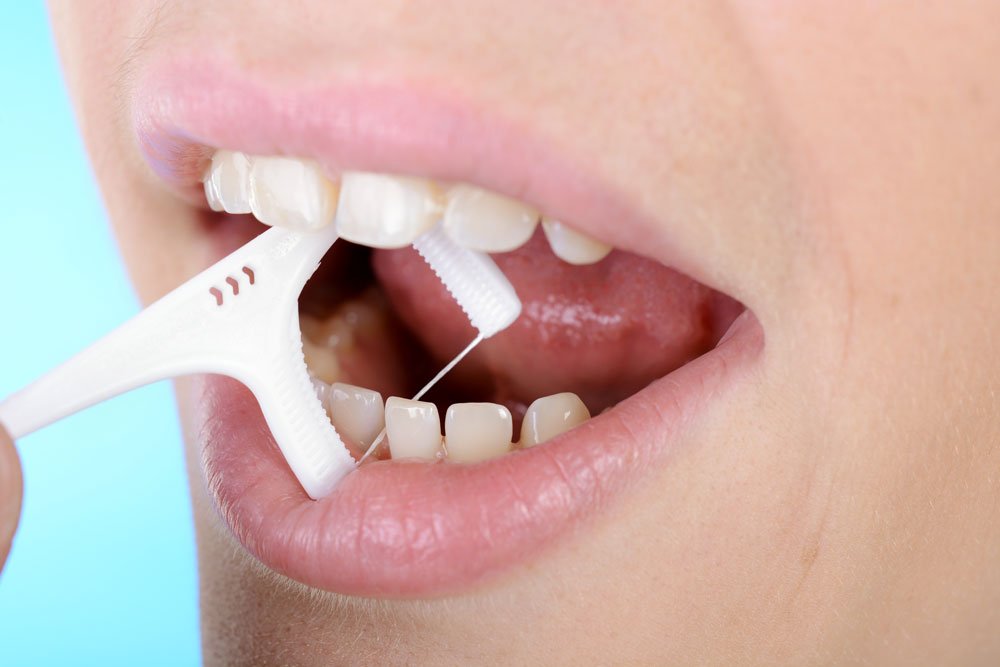 Zahnzwischenräume richtig reinigen und Karies vorbeugen - 4 Methoden vorgestellt