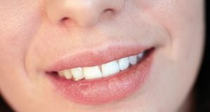 Medizinische Ursachen für spröde Lippen