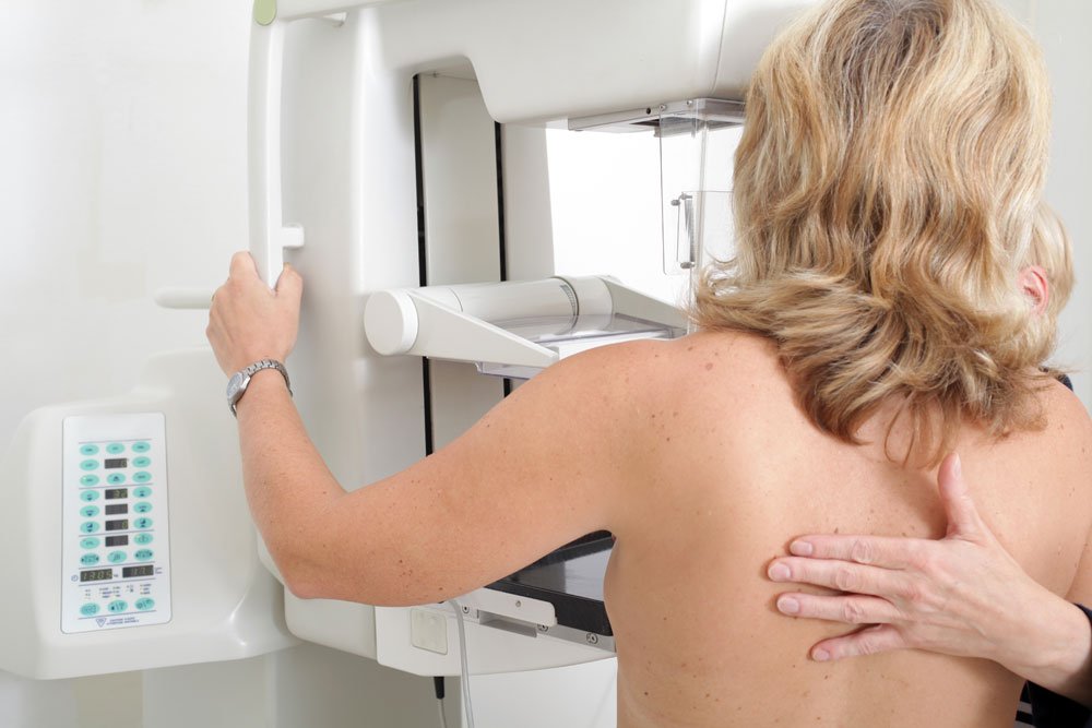 Mammographie Brustkrebs