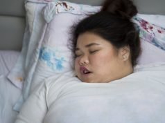 Übergewichtige Frau schläft mit offenem Mund